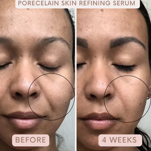 Porecelain™ Skin Refining Serum by Auvê® Beauty