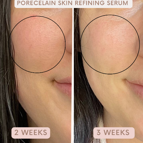 Porecelain™ Skin Refining Serum by Auvê® Beauty